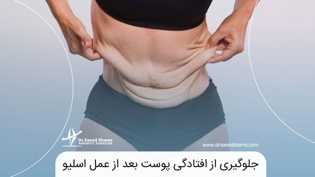 افتادگی پوست بعد از عمل اسلیو