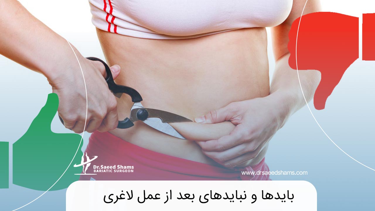 بایدها و نبایدهای بعد از عمل لاغری