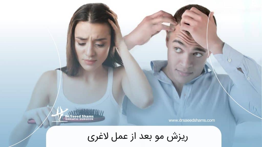 ریزش مو بعد از عمل لاغری