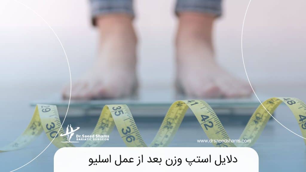 استپ وزن بعد از عمل اسلیو