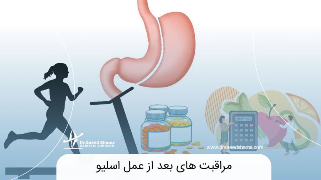 مراقبت های بعد از عمل اسلیو