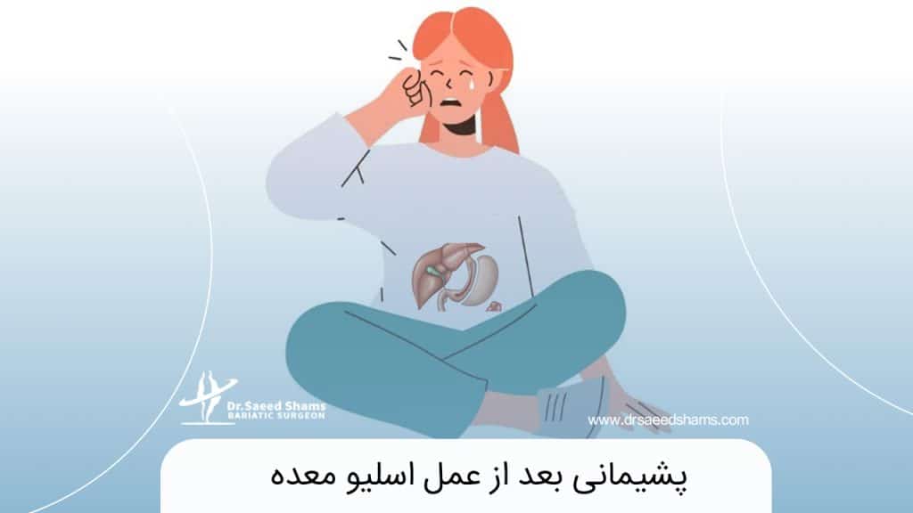 پشیمانی بعد از عمل اسلیو معده
