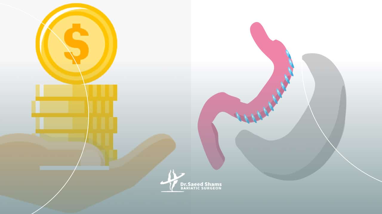 قیمت اسلیو معده 