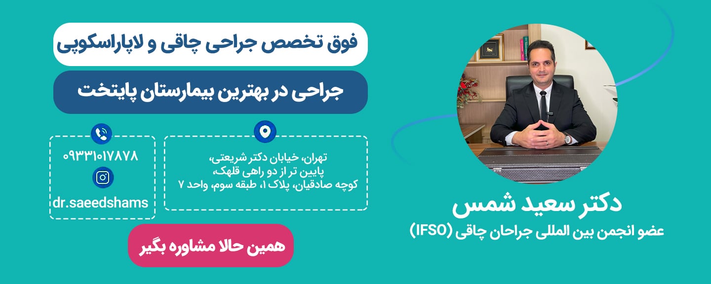معیارهای انتخاب جراح مناسب اسلیو معده