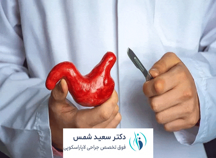 خطرات بای پس معده