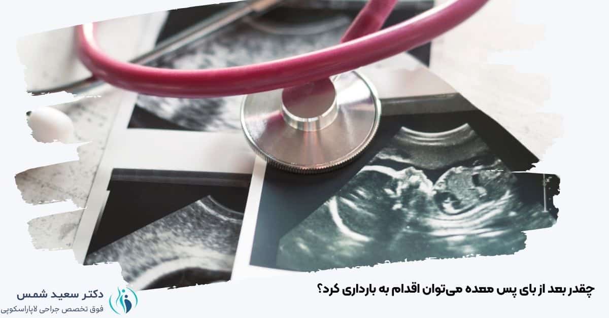 چقدر بعد از بای پس معده می‌توان اقدام به بارداری کرد؟