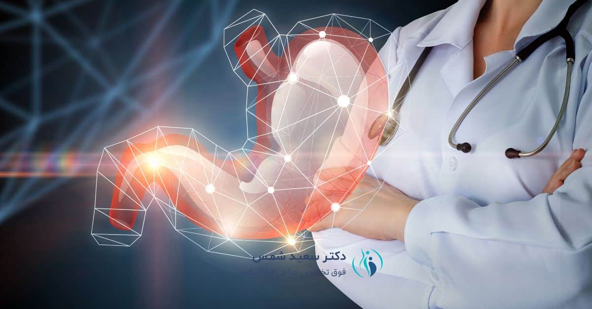 هدف از اسلیو معده