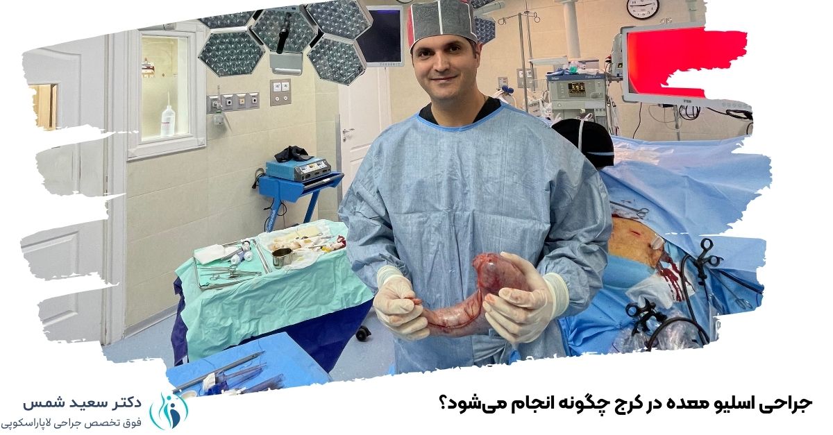 جراحی اسلیو معده  در کرج چگونه انجام می‌شود؟