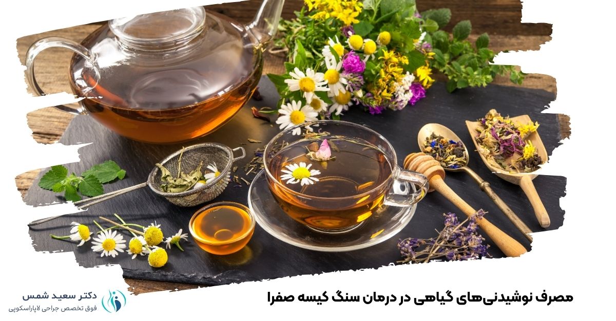 مصرف نوشیدنی‌های گیاهی در درمان سنگ کیسه صفرا