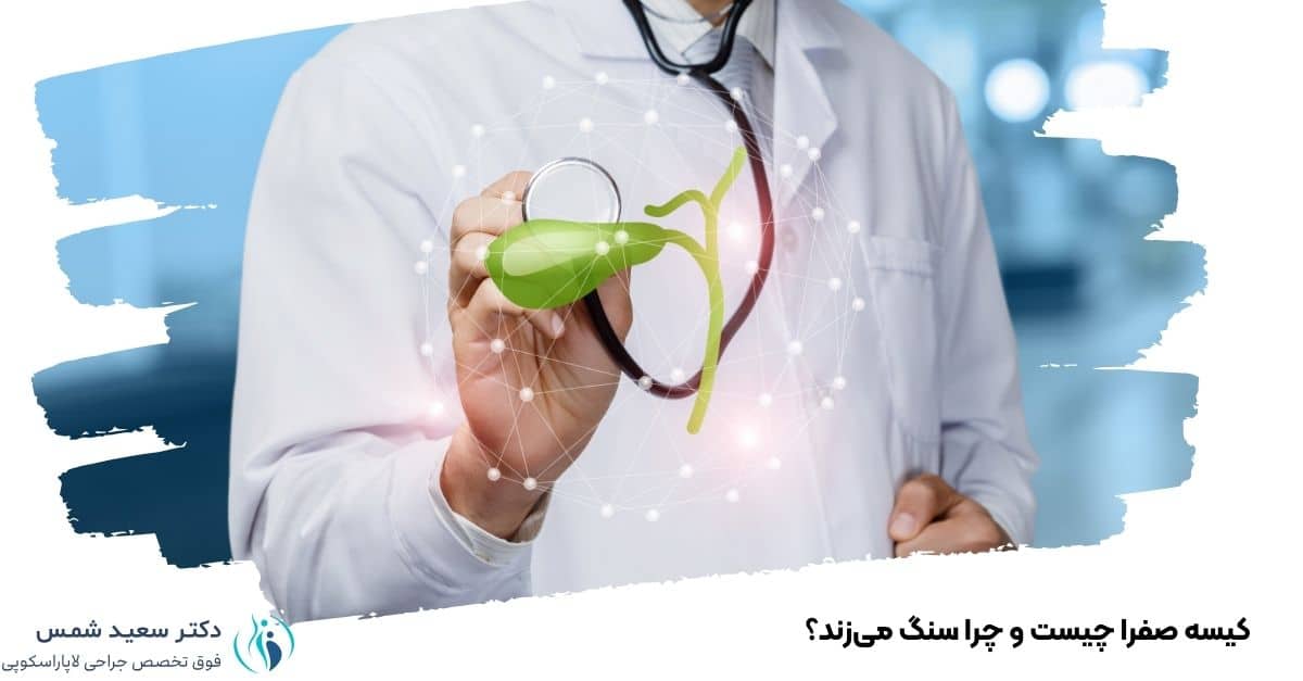 کیسه صفرا چیست و چرا سنگ می‌زند؟