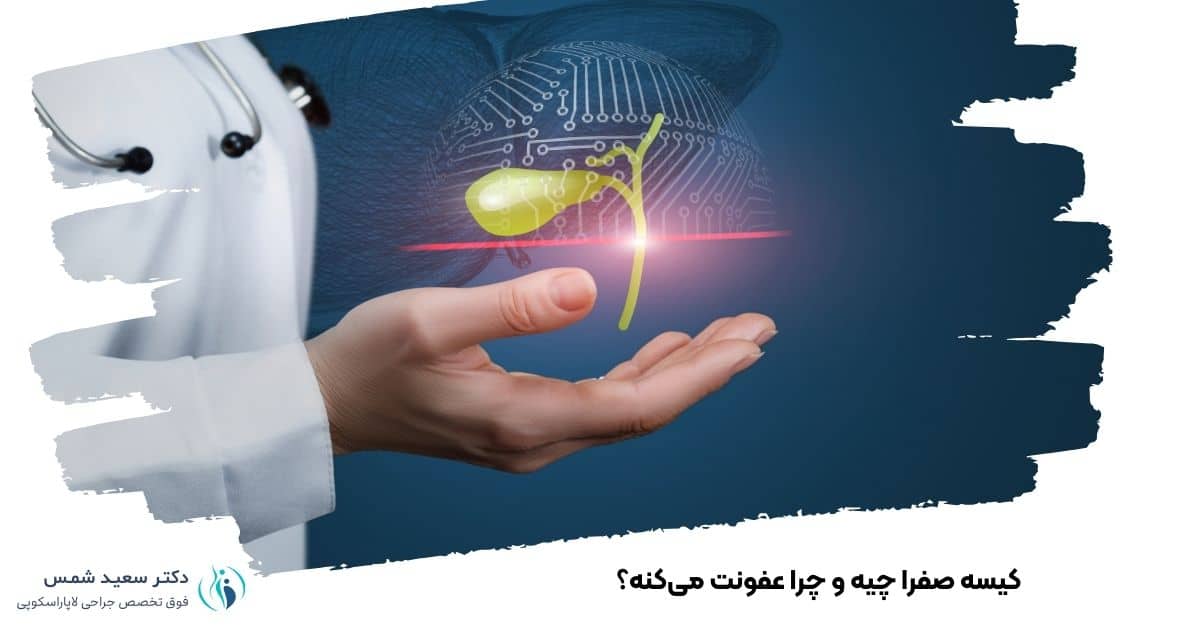کیسه صفرا چیه و چرا عفونت می‌کنه؟
