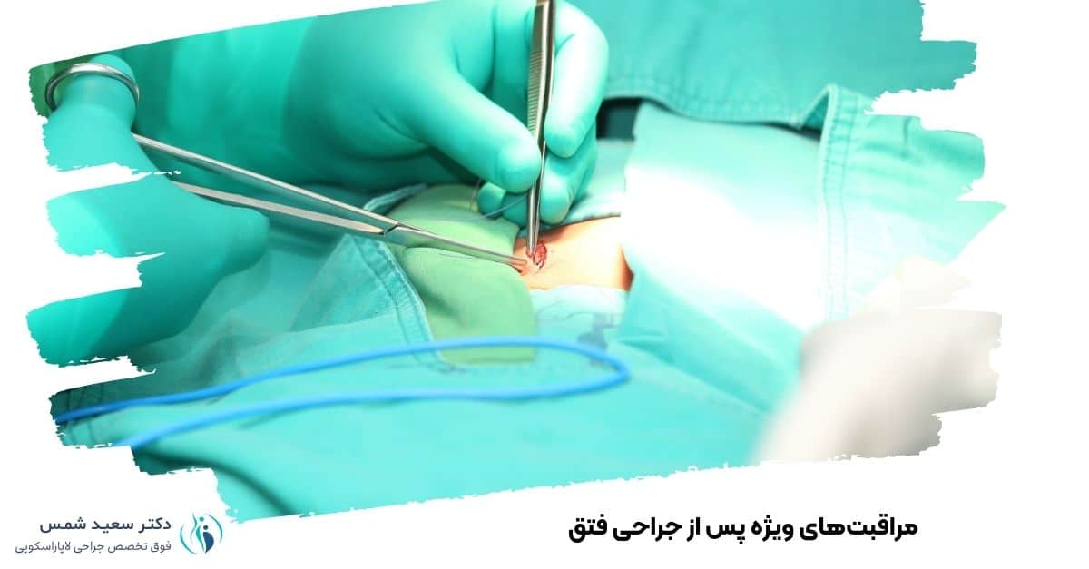 مراقبت‌های ویژه پس از جراحی فتق