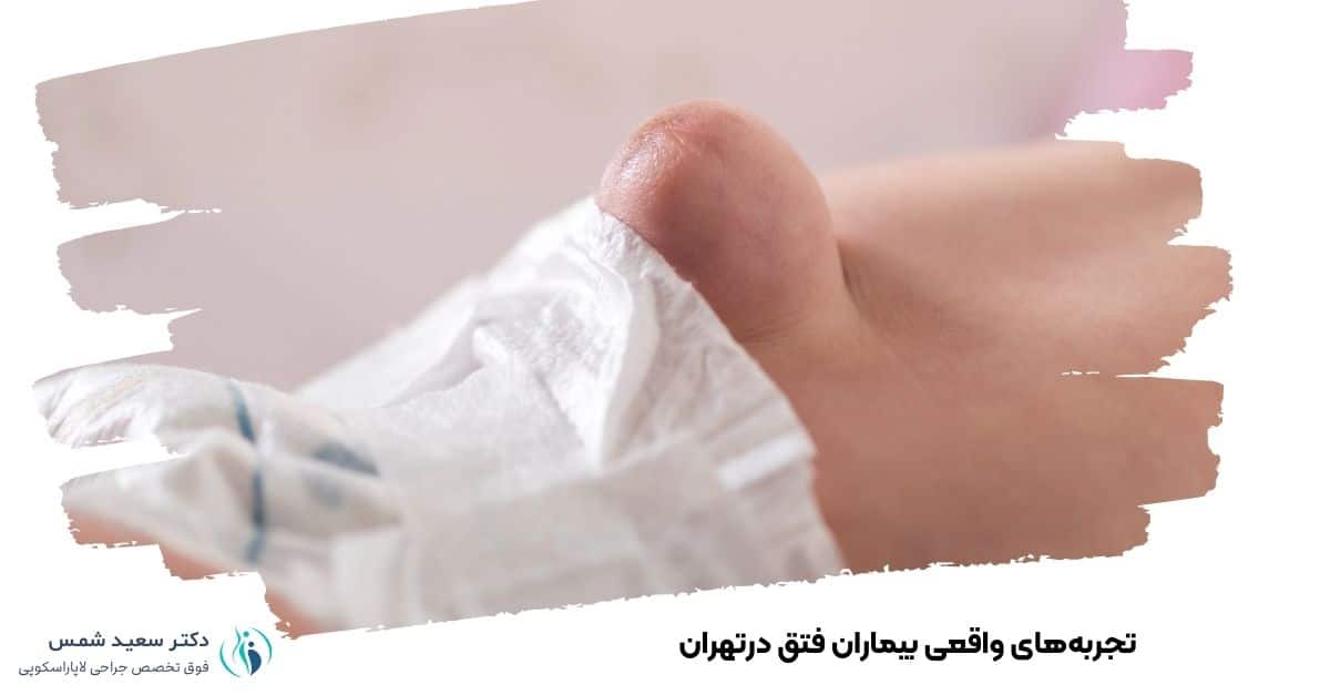 تجربه‌های واقعی بیماران فتق درتهران