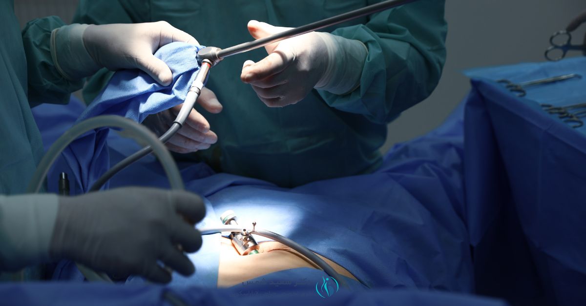 لاپاراسکوپی کیسه صفرا