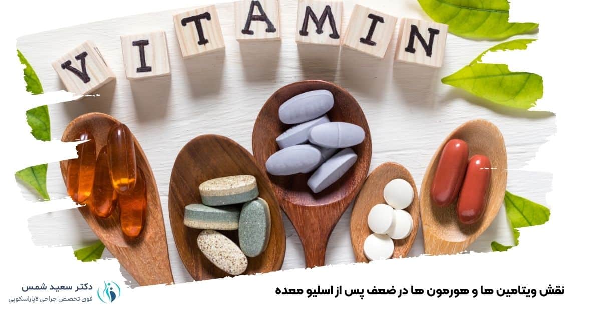 نقش ویتامین ها و هورمون ها در ضعف پس از اسلیو معده 