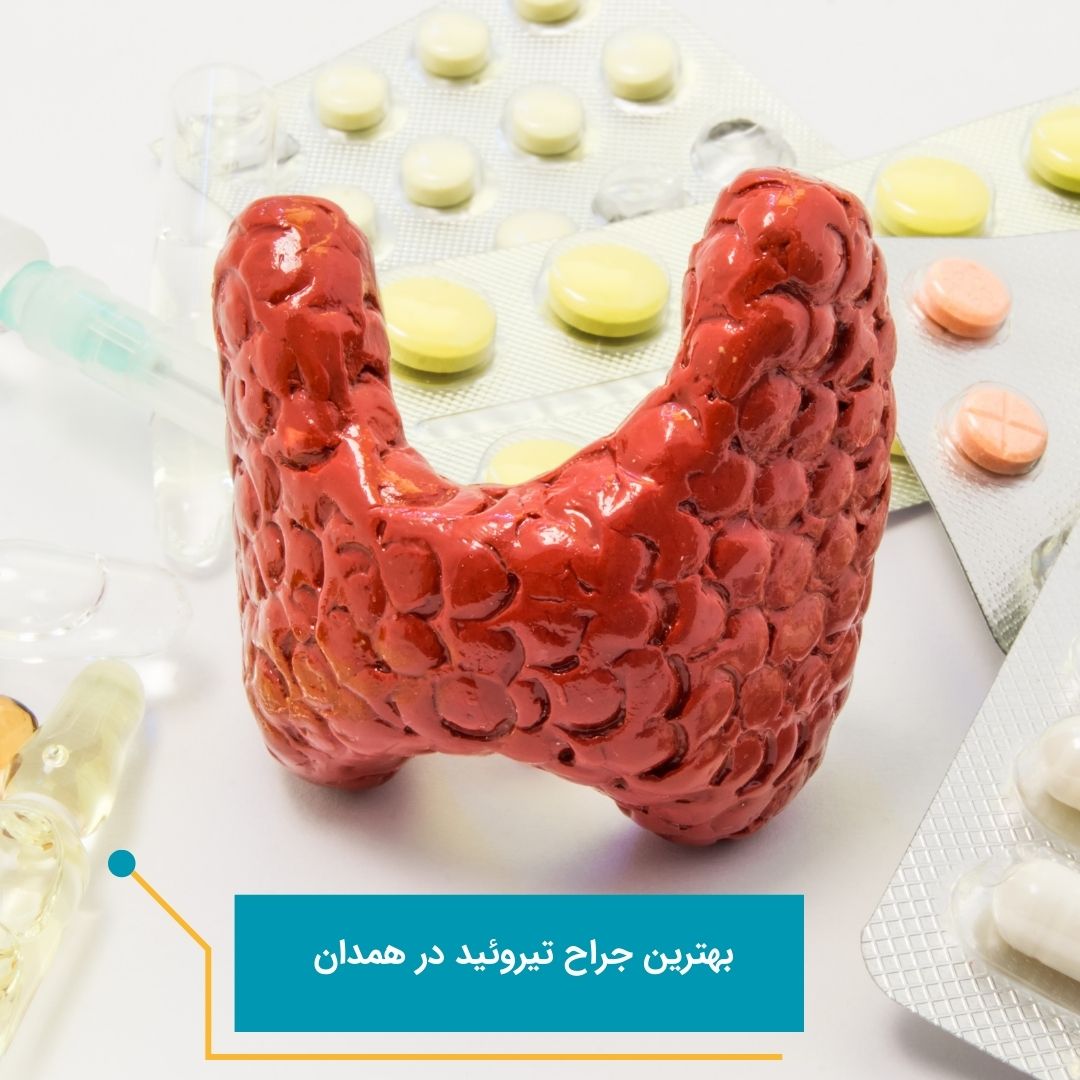 جراح تیروئيد در همدان