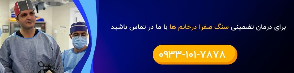 درمان سنگ صفرا در خانم ها