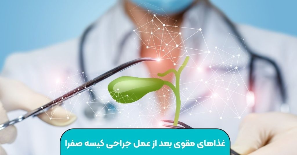 غذاهای مقوی بعد از عمل جراحی کیسه صفرا
