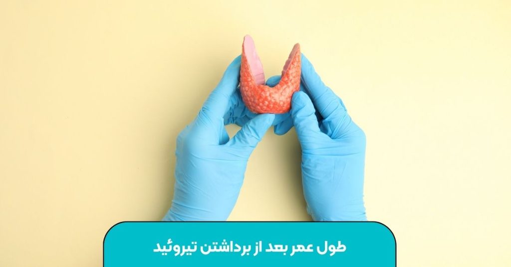 طول عمر بعد از برداشتن تیروئید