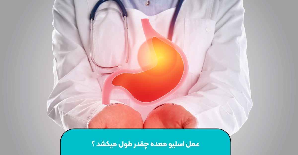 عمل اسلیو معده چقدر طول میکشد ؟