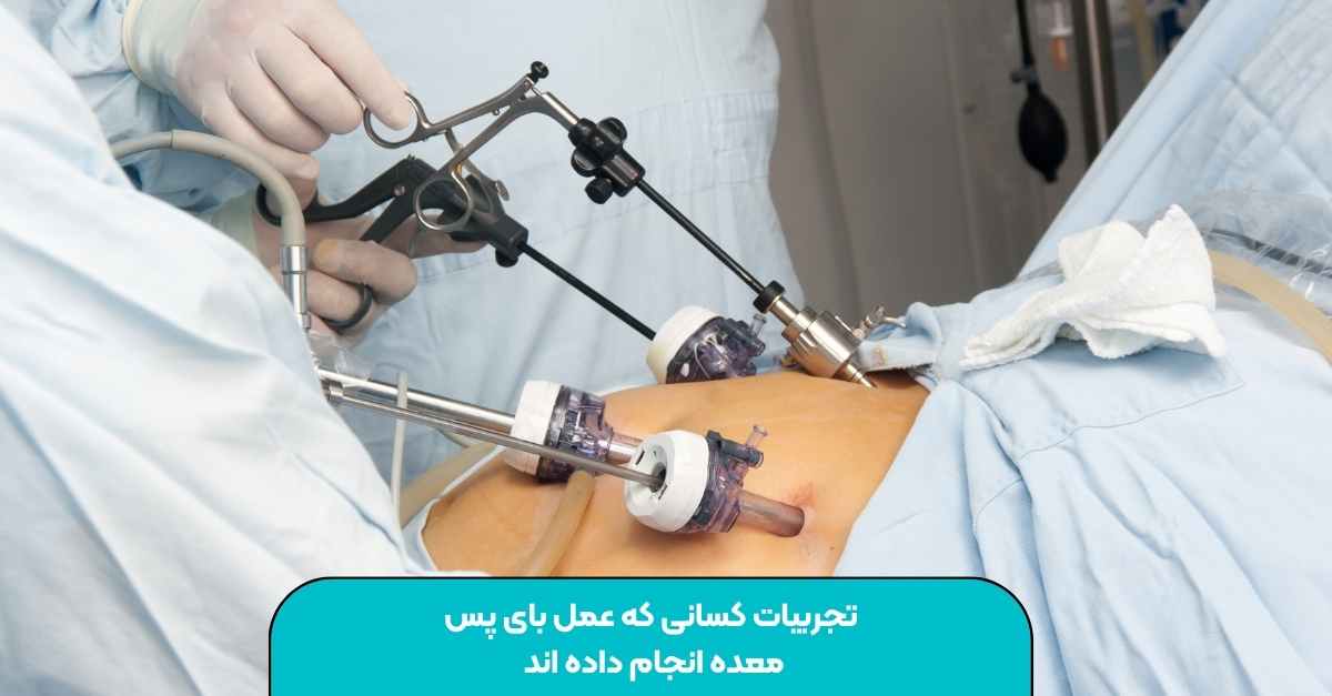 تجربیات کسانی که عمل بای پس معده انجام داده اند