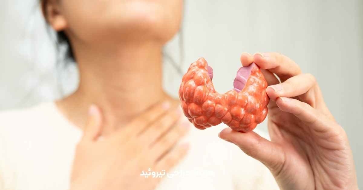 هزینه جراحی تیروئید