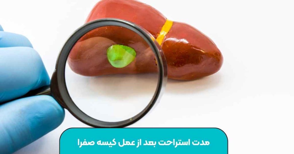 مدت استراحت بعد از عمل کیسه صفرا