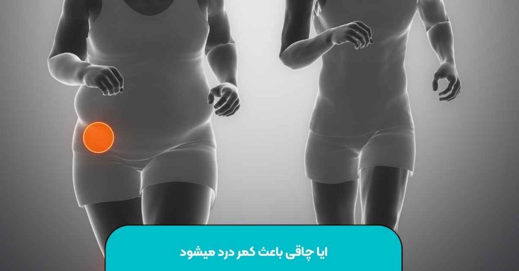 ایا چاقی باعث کمر درد میشود