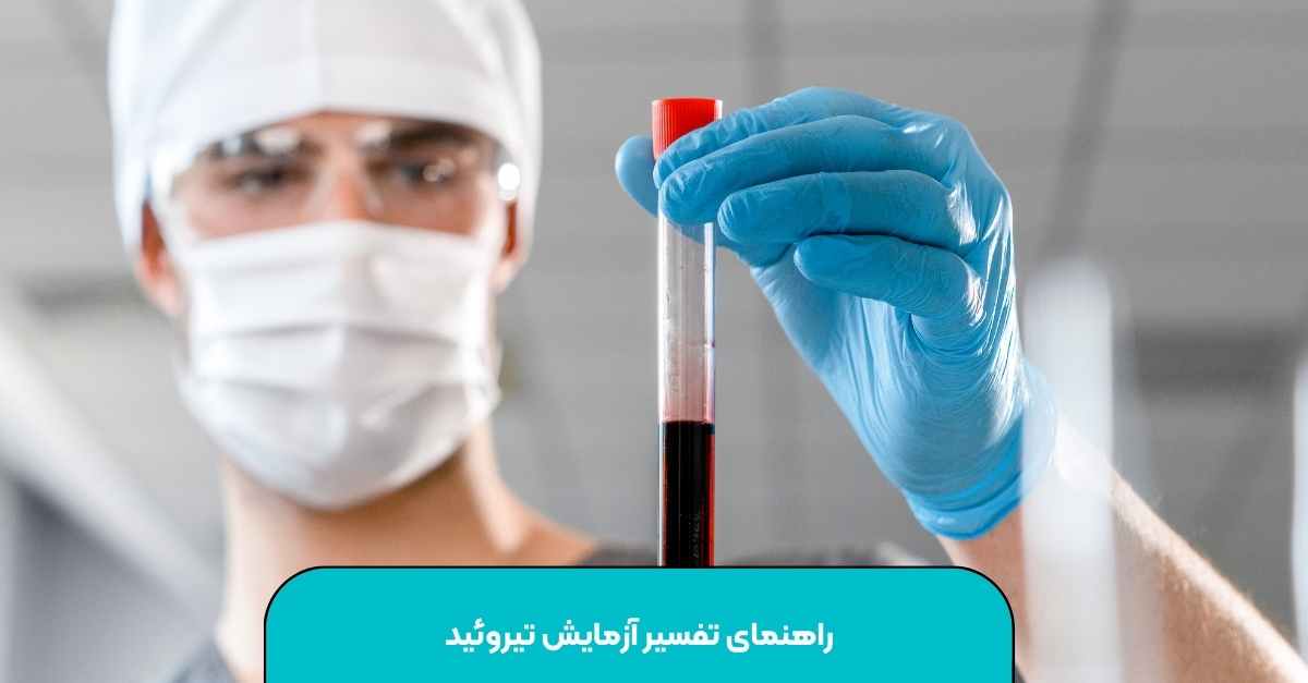 راهنمای تفسیر آزمایش تیروئید