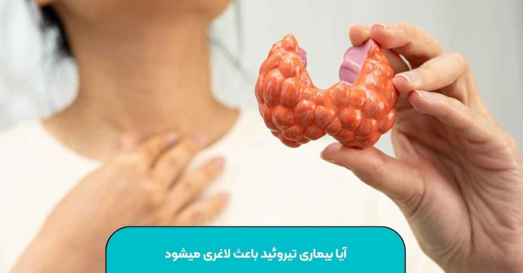 بیماری تیروئید باعث لاغری میشود