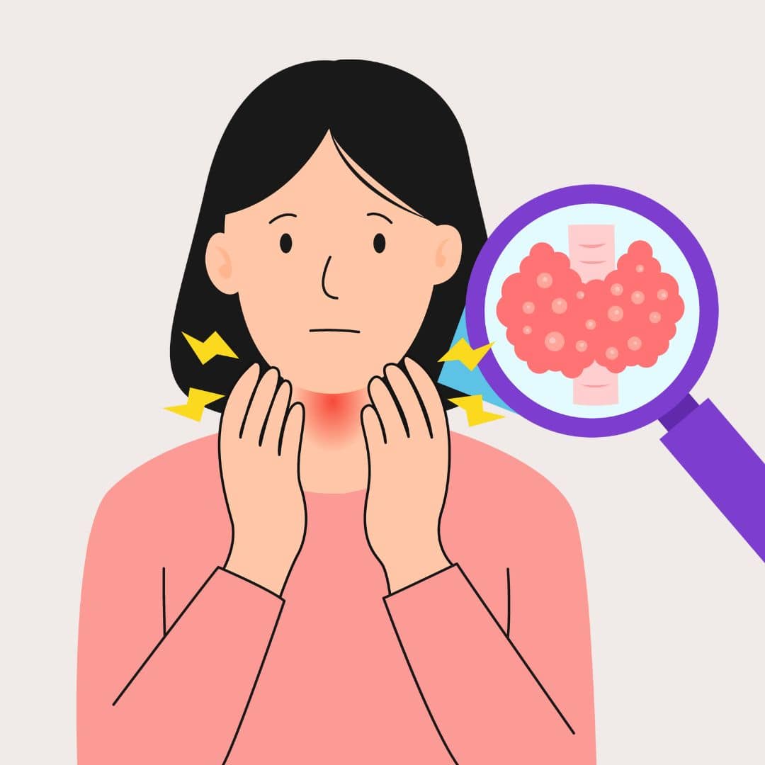 برداشتن کامل تیرویید