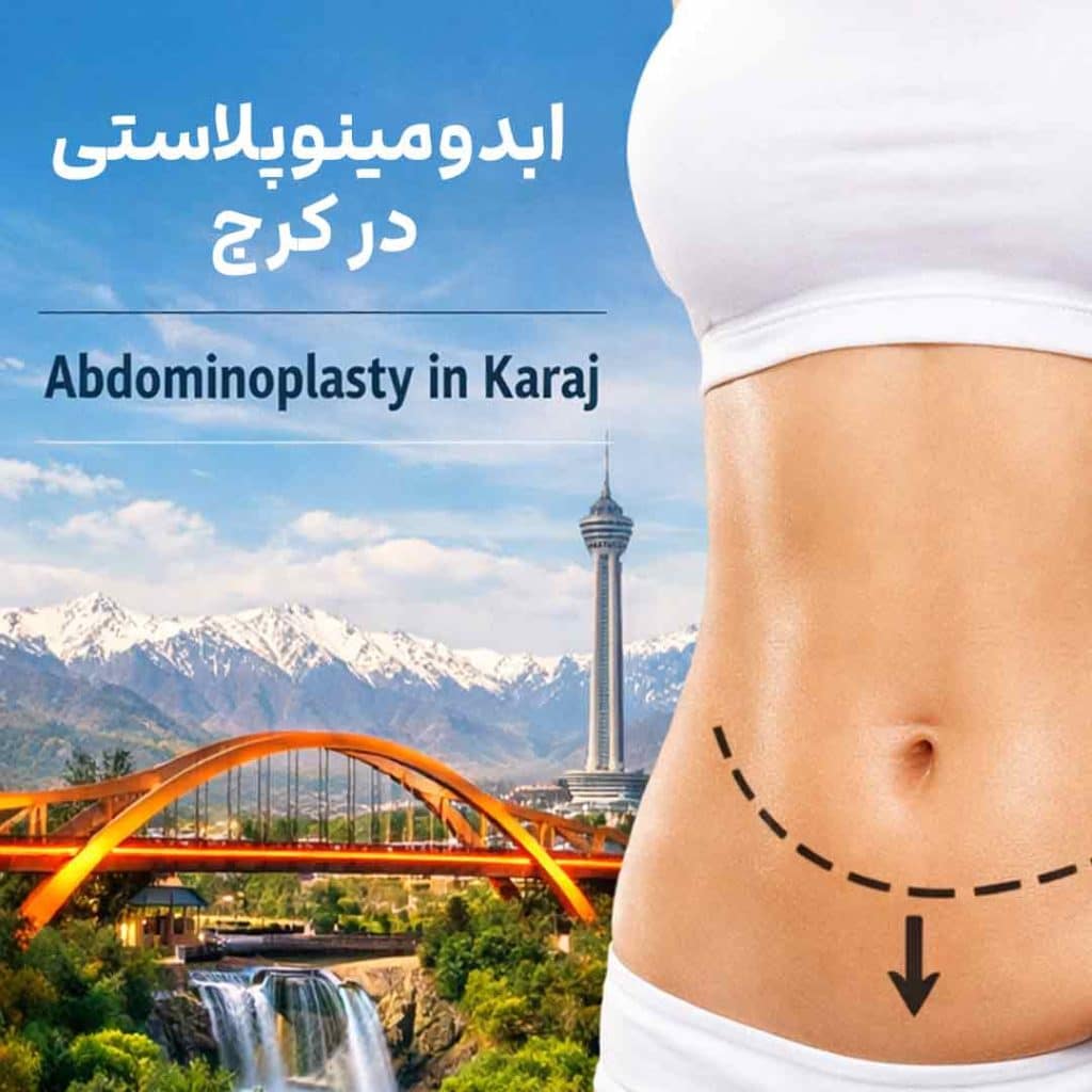 دکتر ابدومینوپلاستی در کرج