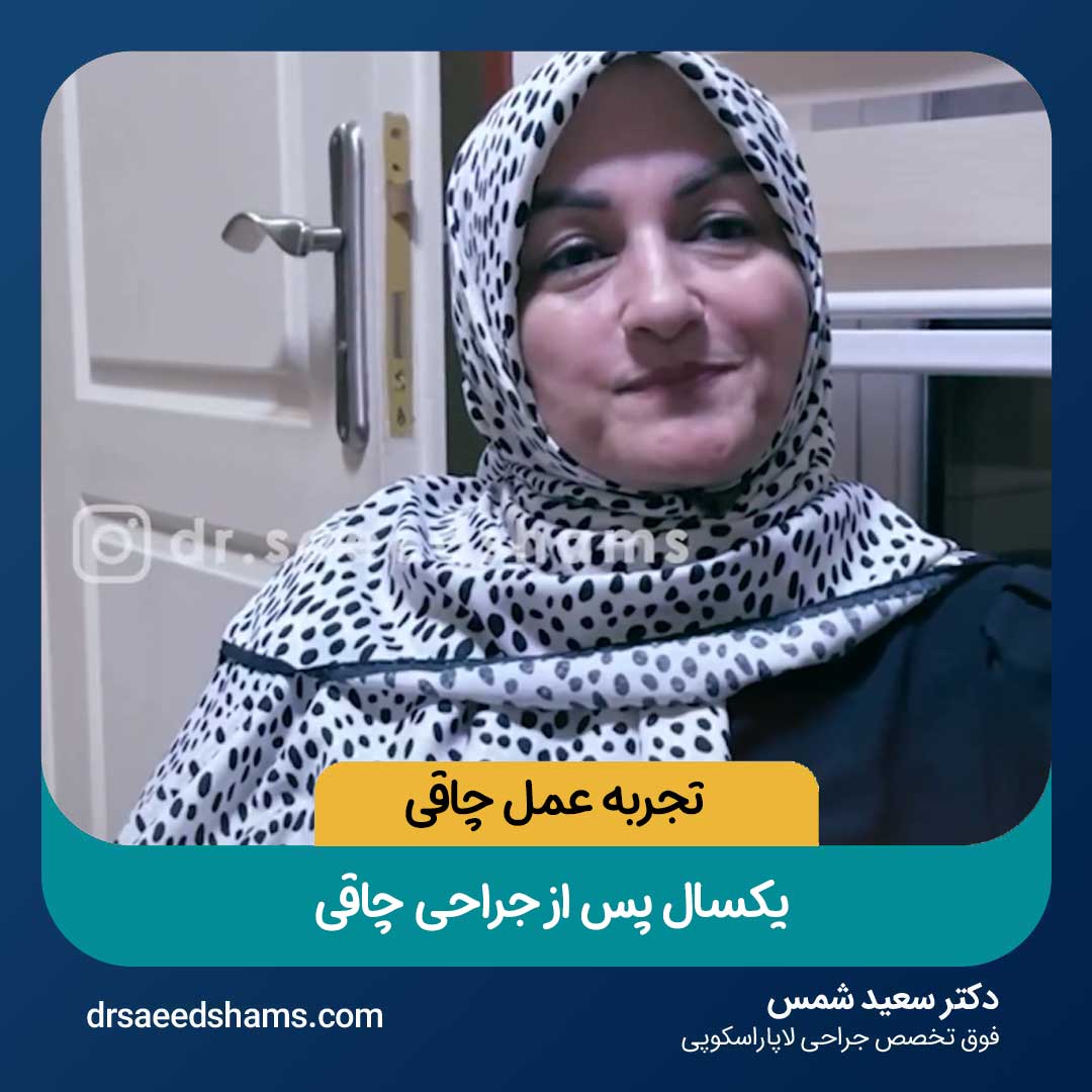 تجربه یکسال پس از جراحی چاقی