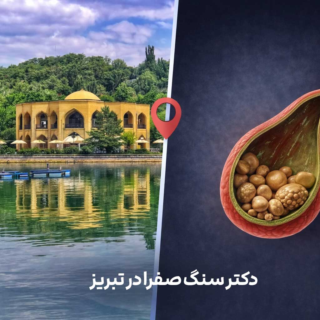 جراح سنگ صفرا در تبریز