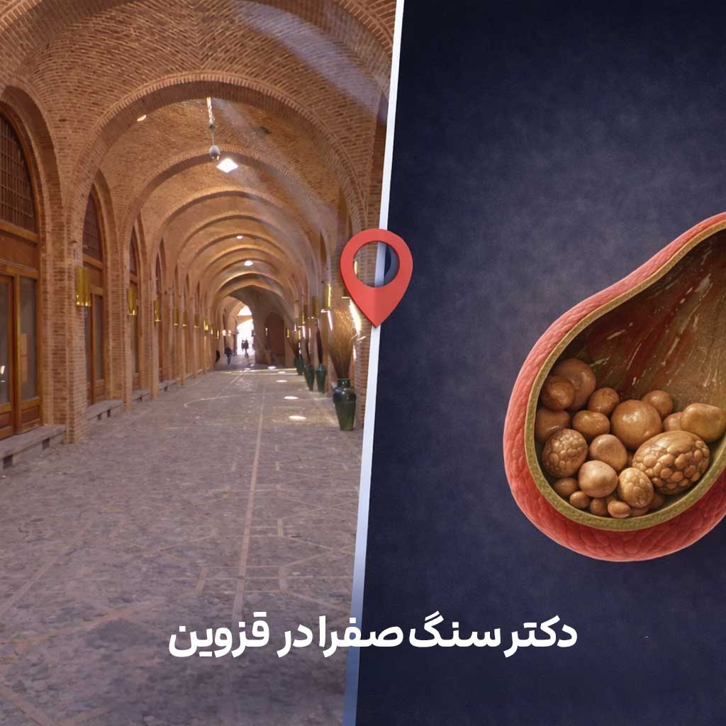 جراح سنگ صفرا در قزوین