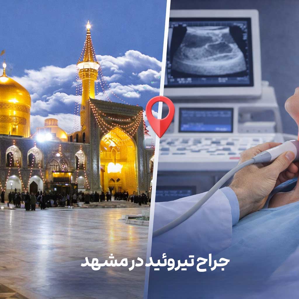 جراح تیروئید در مشهد