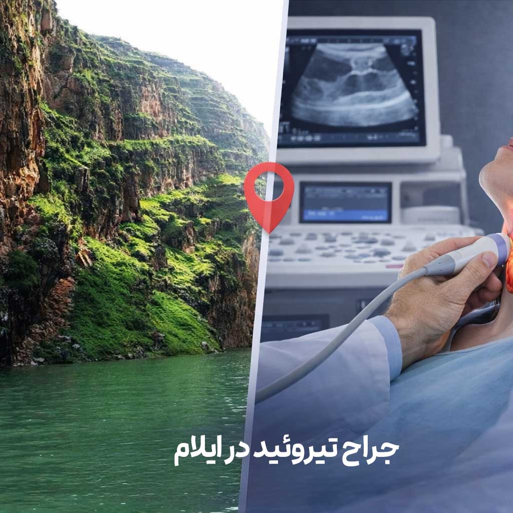 جراح تیروئید در ایلام