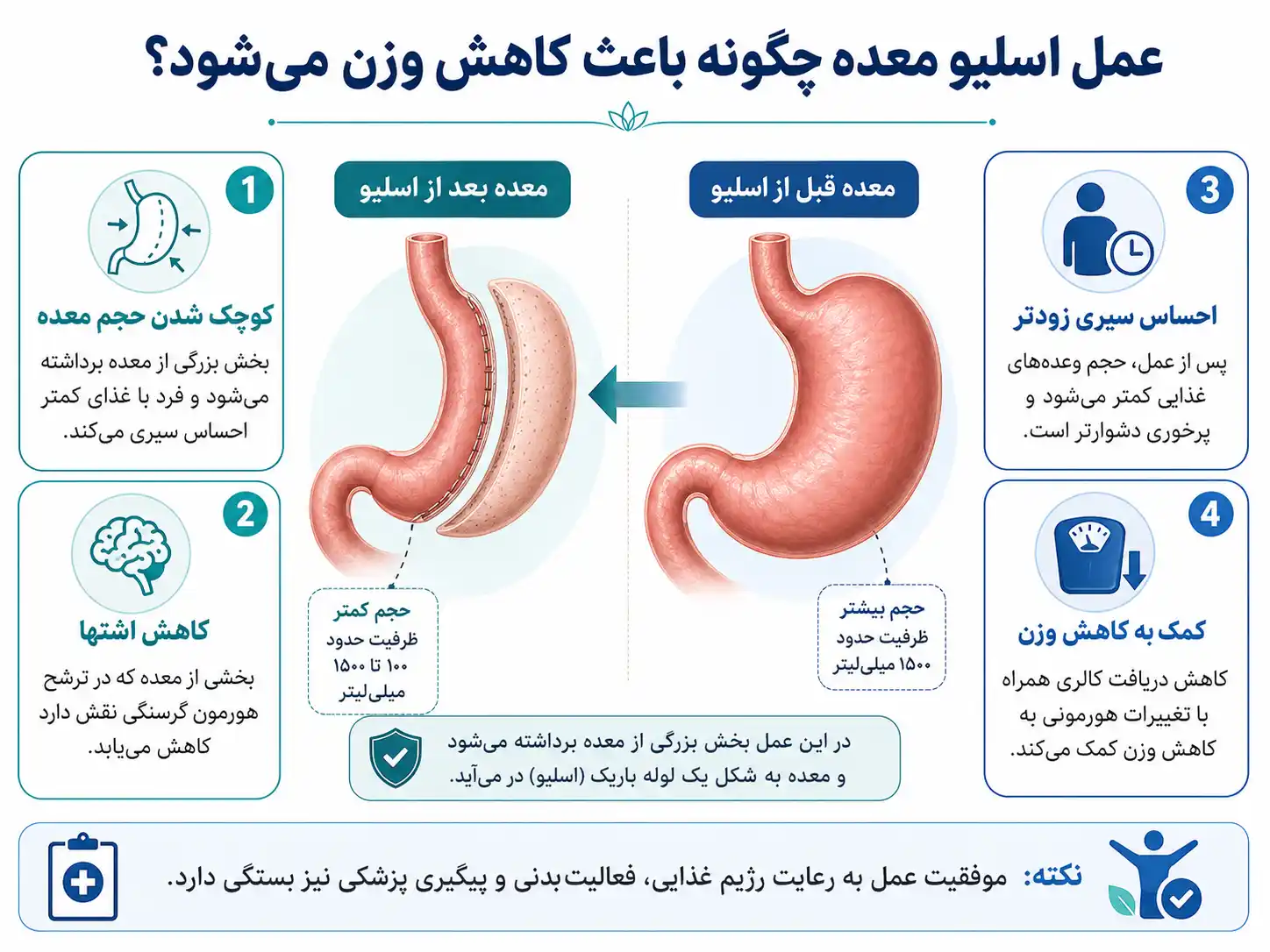عمل اسلیو معده چگونه باعث کاهش وزن میشود؟