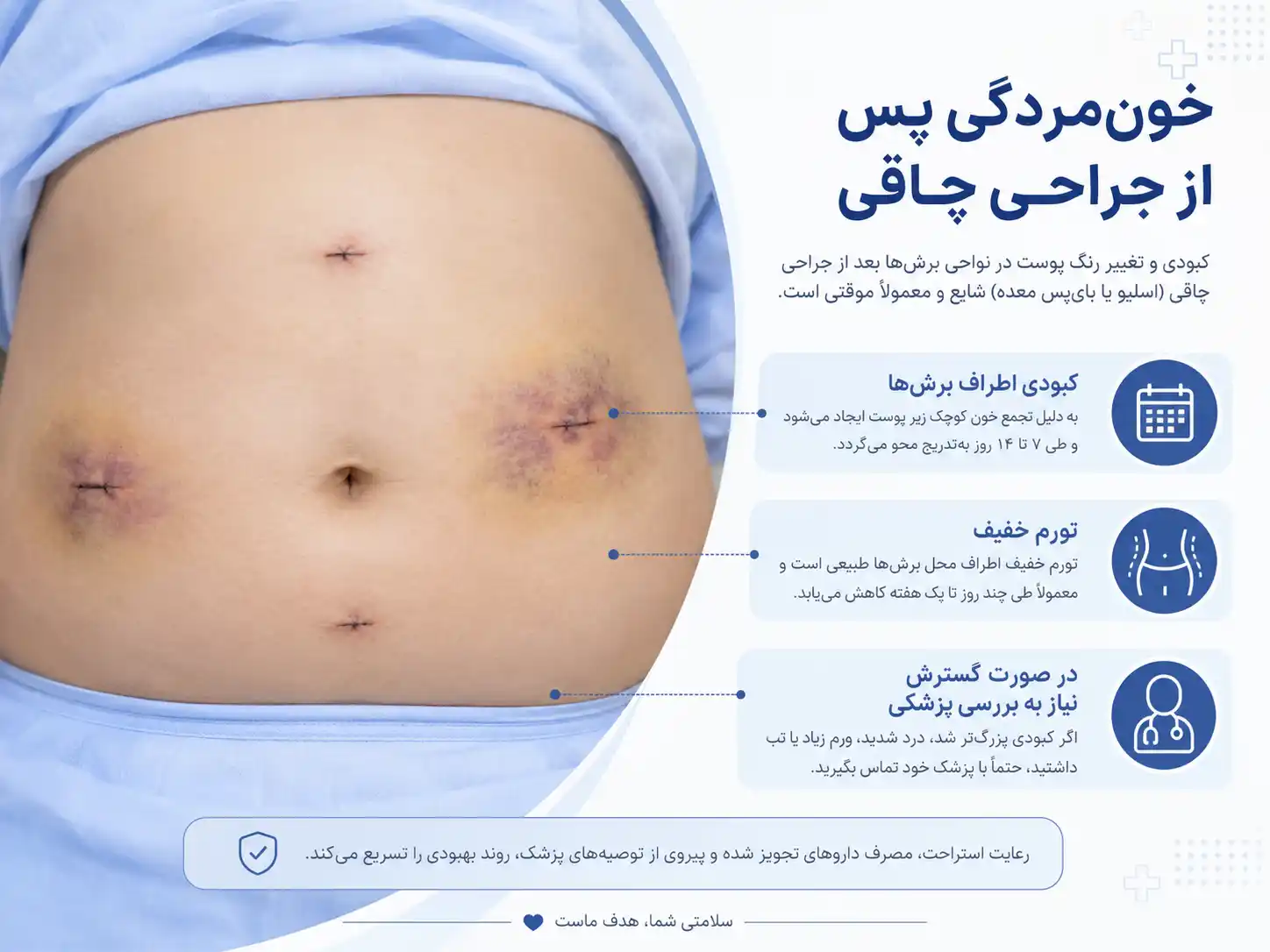 خون مردگی پس از جراحی چاقی