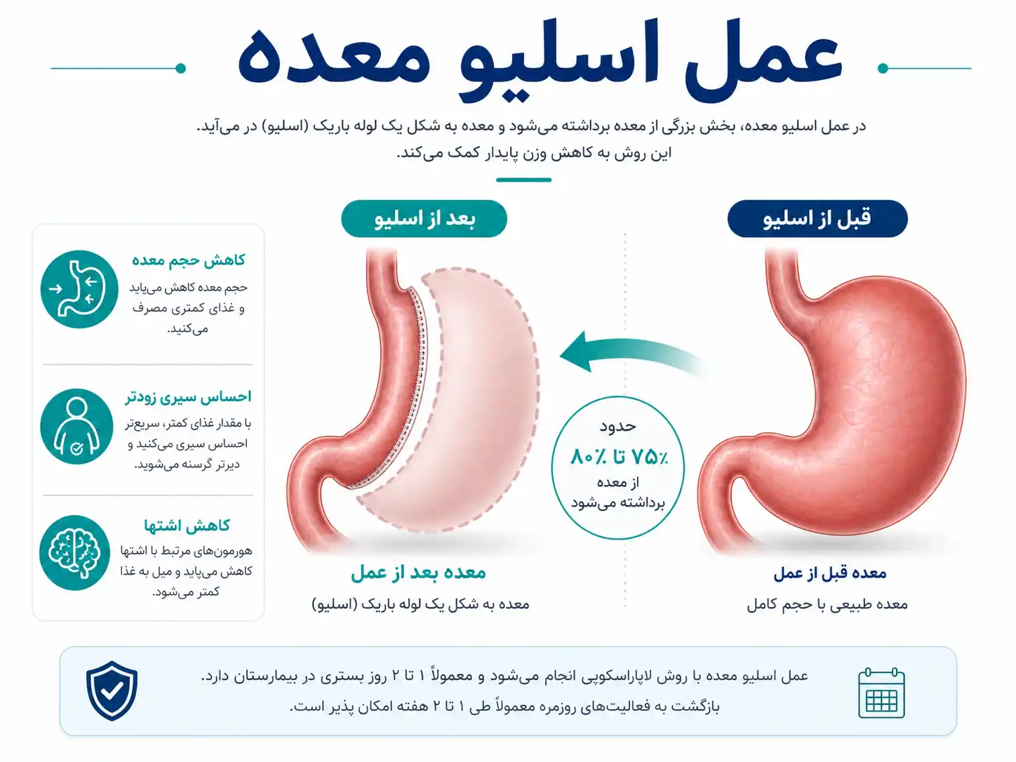 موفقیت عمل اسلیو معده