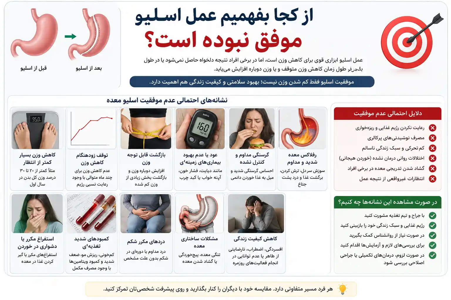 موفقیت نبودن عمل اسلیو معده