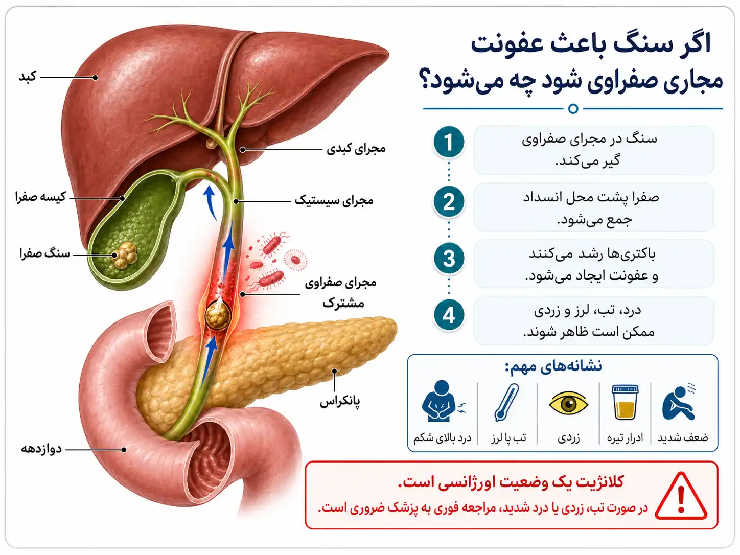 اگر سنگ باعث عفونت مجاری صفراوی شود چه میشود؟