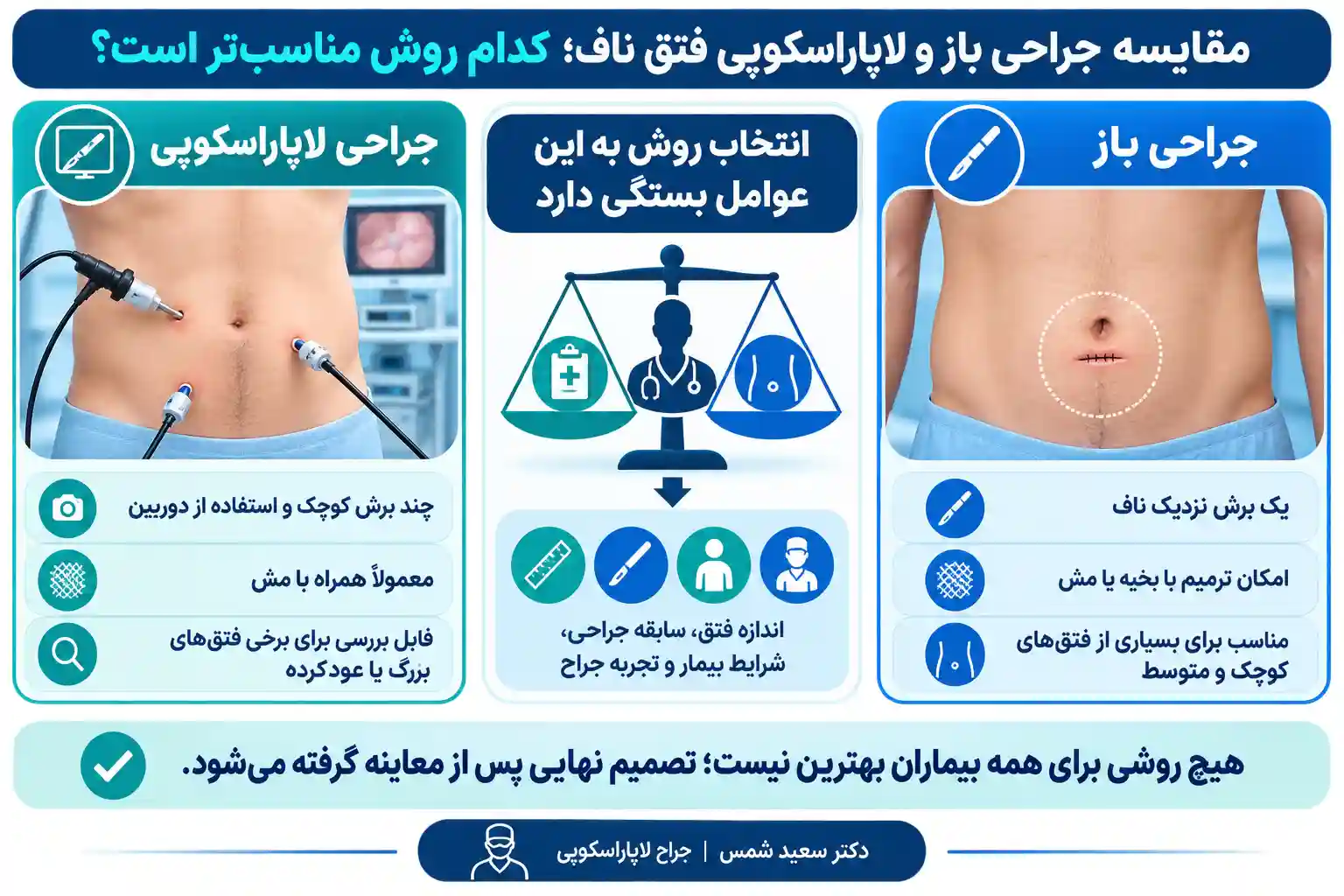 مقایسه جراحی باز و لاپاراسکوپی فتق ناف کدام روش مناسبتر است؟